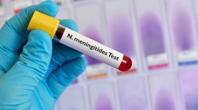 Nuovo caso di meningite a Lucca