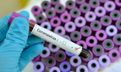 Coronavirus: piccolo aumento di casi rispetto a ieri