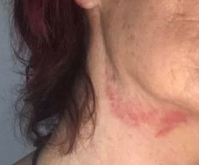 Donna aggredita in pieno centro