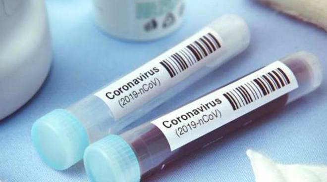 Coronavirus, 3324 nuovi casi in Toscana il 18 febbraio. Ci sono anche 28 decessi ma ricoveri in netto calo