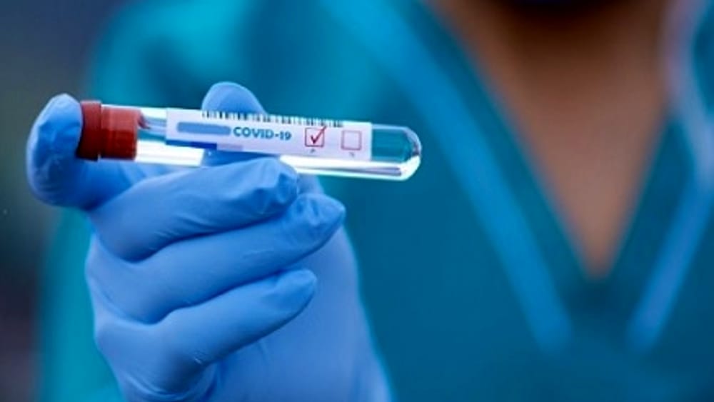 Coronavirus: 472 nuovi casi e 15 decessi