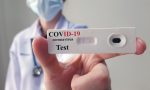 Coronavirus, 1.034 nuovi casi. Età media 46 anni. I decessi sono due