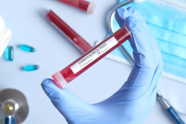 Coronavirus: 2.787 nuovi casi in Toscana, 41.583 i positivi (+2.143), 214 in T.I. (+4), 30 deceduti