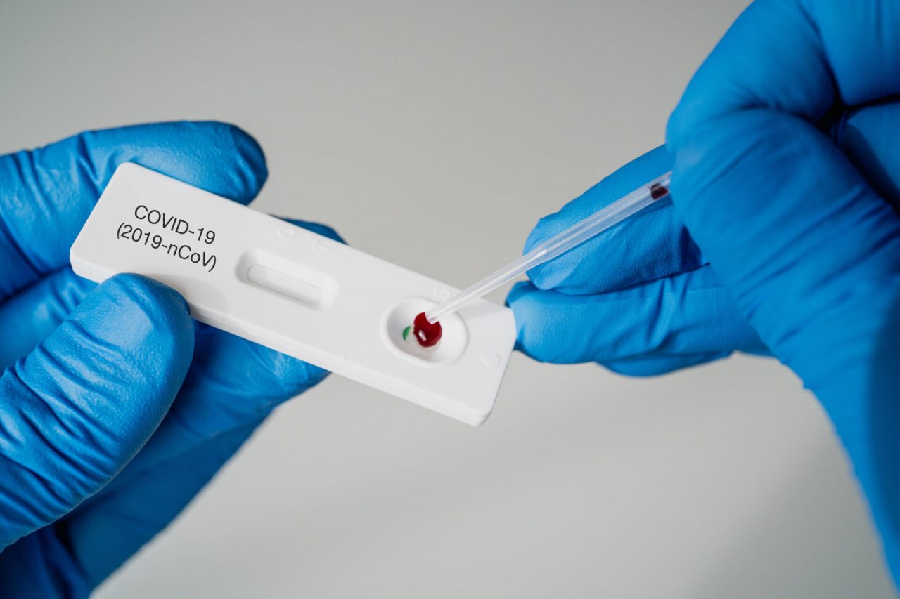 Tamponi a prezzo calmierato: test rapidi a 15, molecolari a massimo 80 euro