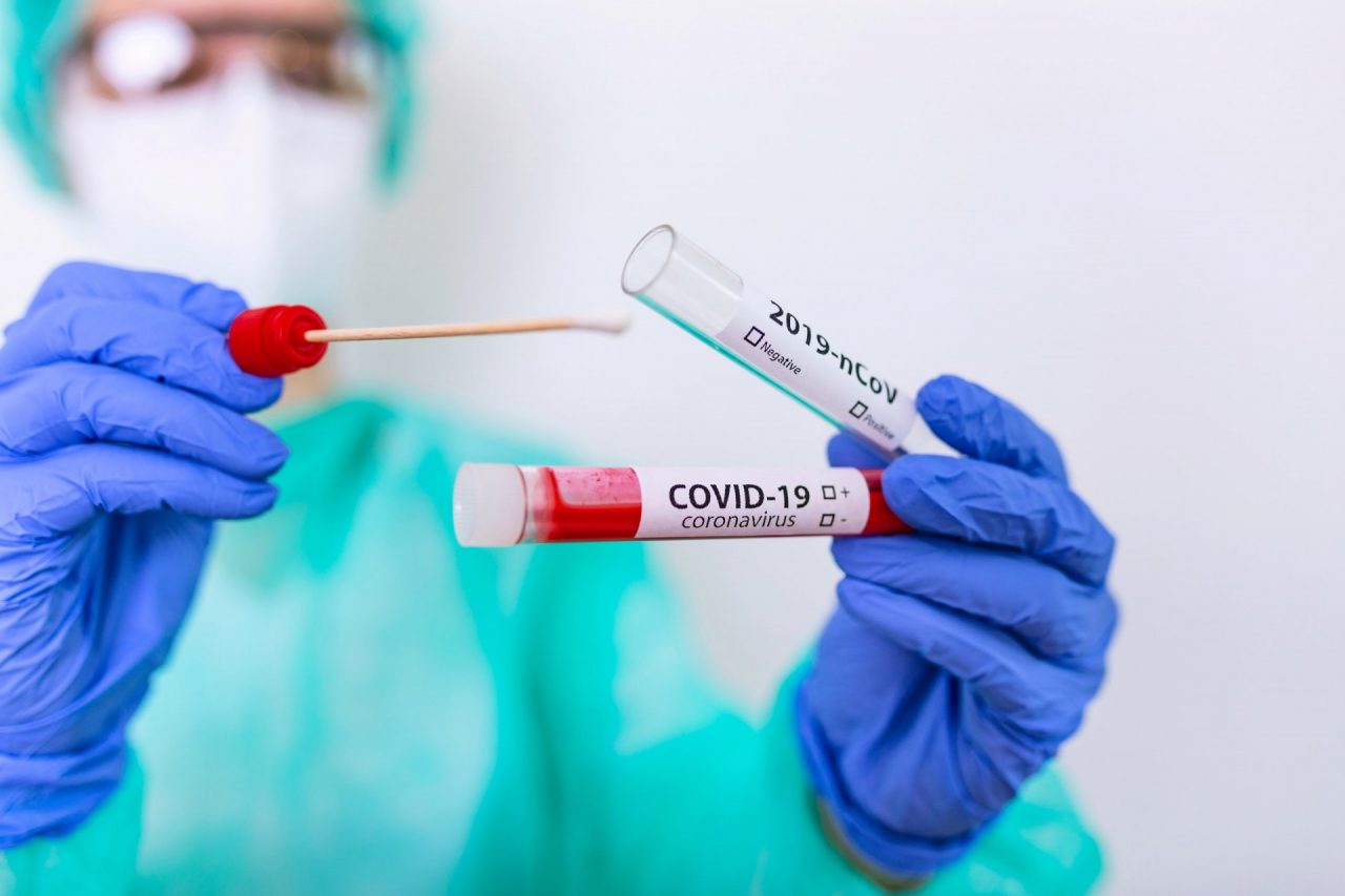 Covid, i casi di oggi in Toscana: 510 i nuovi contagi, età media 44 anni, e 8 decessi