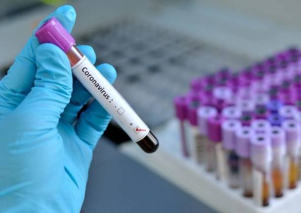 Coronavirus, 3500 nuovi casi in Toscana il 23 luglio: ricoveri in calo (-32) e soprattutto zero decessi