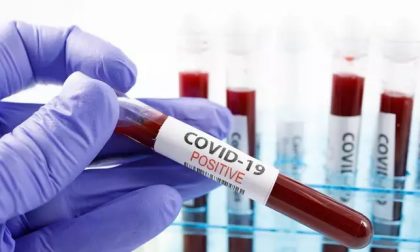 Coronavirus, 376 i nuovi positivi, età media 42 anni. I decessi sono tre