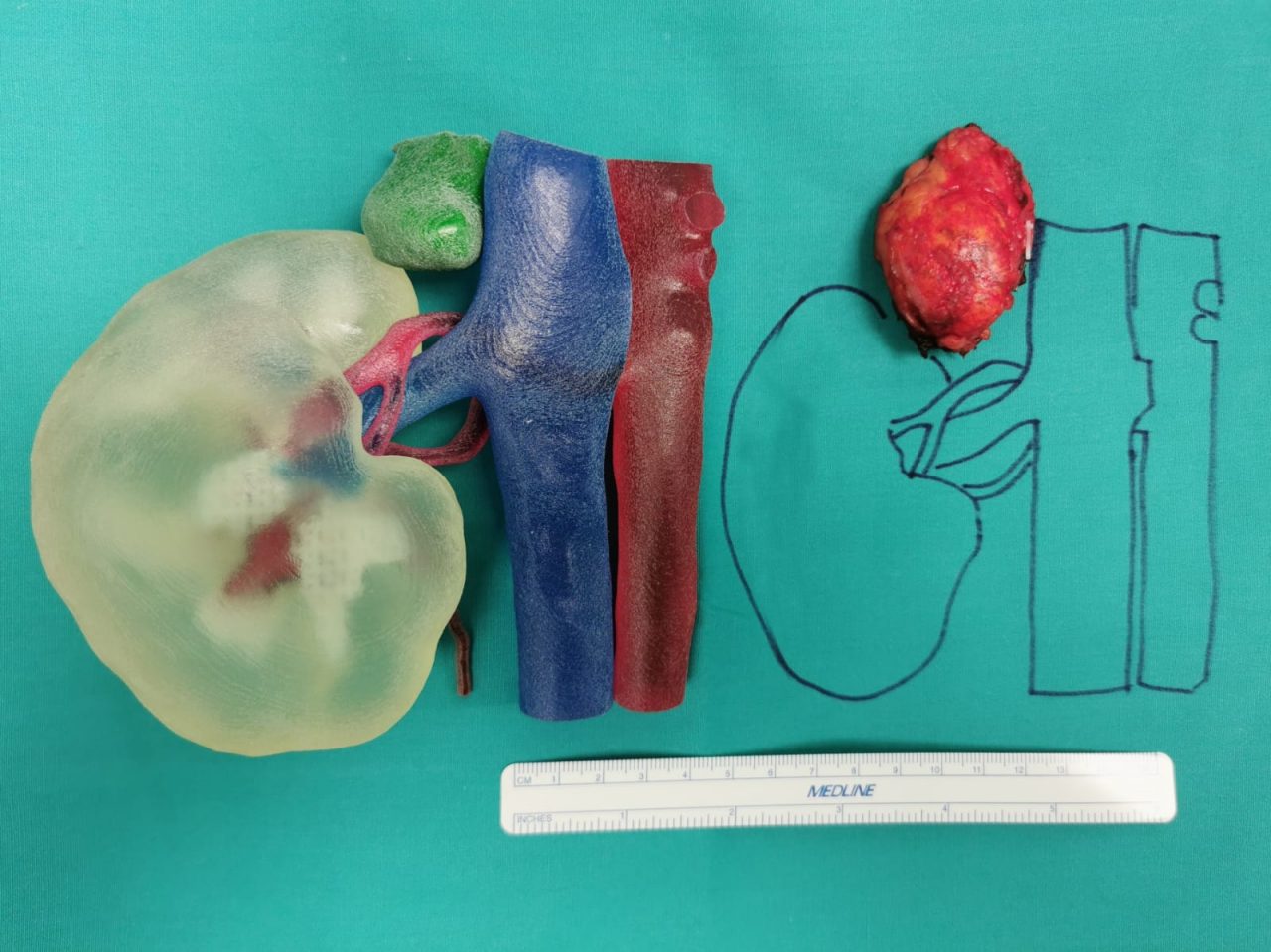 La tecnologia in 3D arriva in sala operatoria al Santo Stefano di Prato