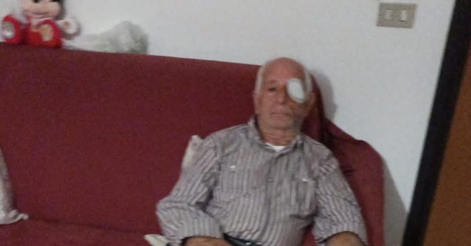 Dimesso Salvatore Iocca, l’83enne picchiato a Campi