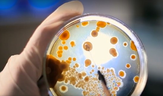 Legionella nell’aretino, un contagiato: chiuse due scuole e un campo sportivo