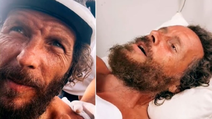 Incidente in bici per Jovanotti a Santo Domingo: femore e clavicola rotti