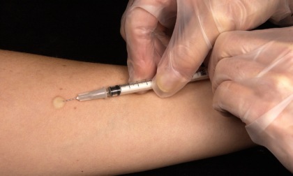 Grosseto, caso di tubercolosi in un nido. Ecco come comportarsi