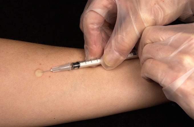 Grosseto, caso di tubercolosi in un nido. Ecco come comportarsi