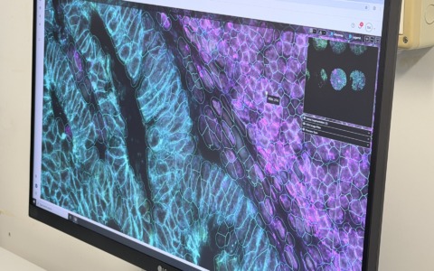 Tecnologia di ultima generazione per le analisi delle cellule
