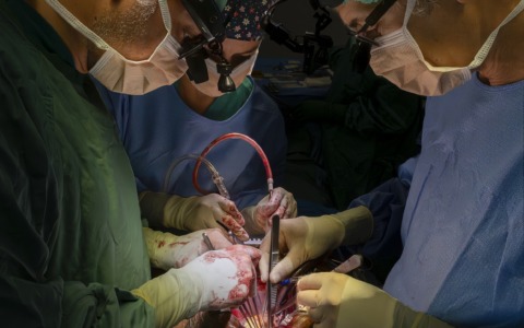 Pisa, intervento record: bioprotesi al cuore degenerata sostituita senza aprire il torace